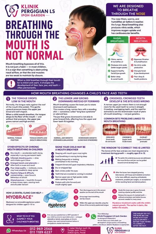 Mouth Breathing in Children — Why It Is More Than Just a Habit