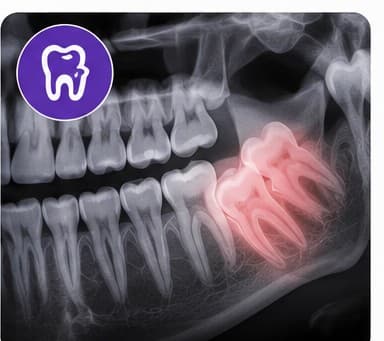 3D CBCT X-Ray