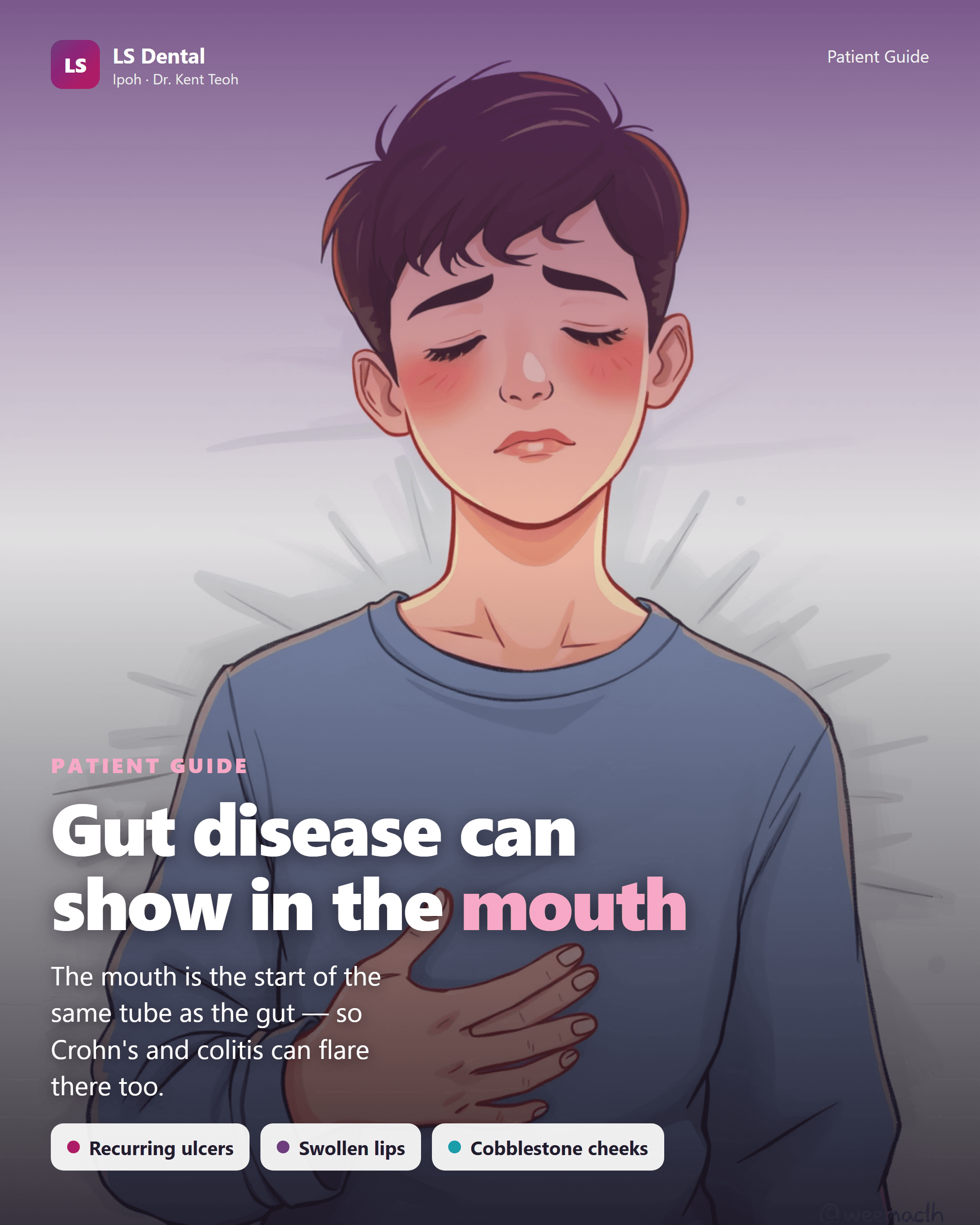 Gut disease can show in the mouth