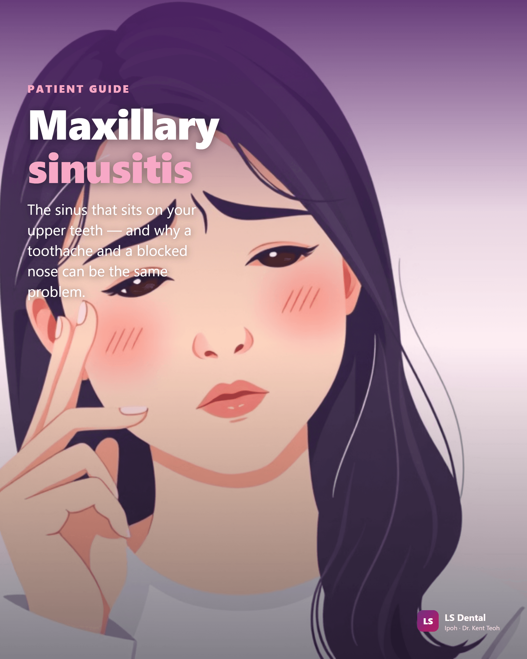 Maxillary sinusitis