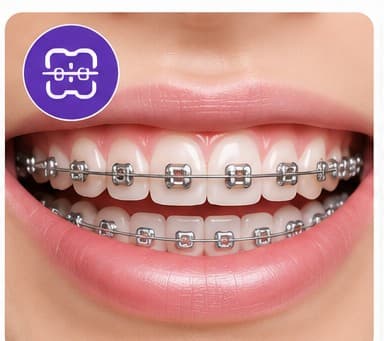 Braces / Orthodontics