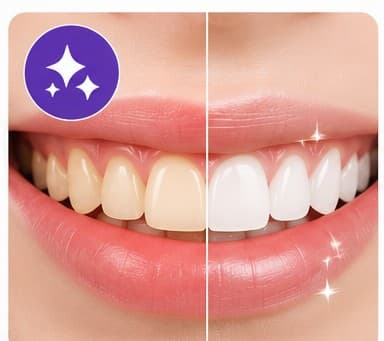 Teeth Whitening