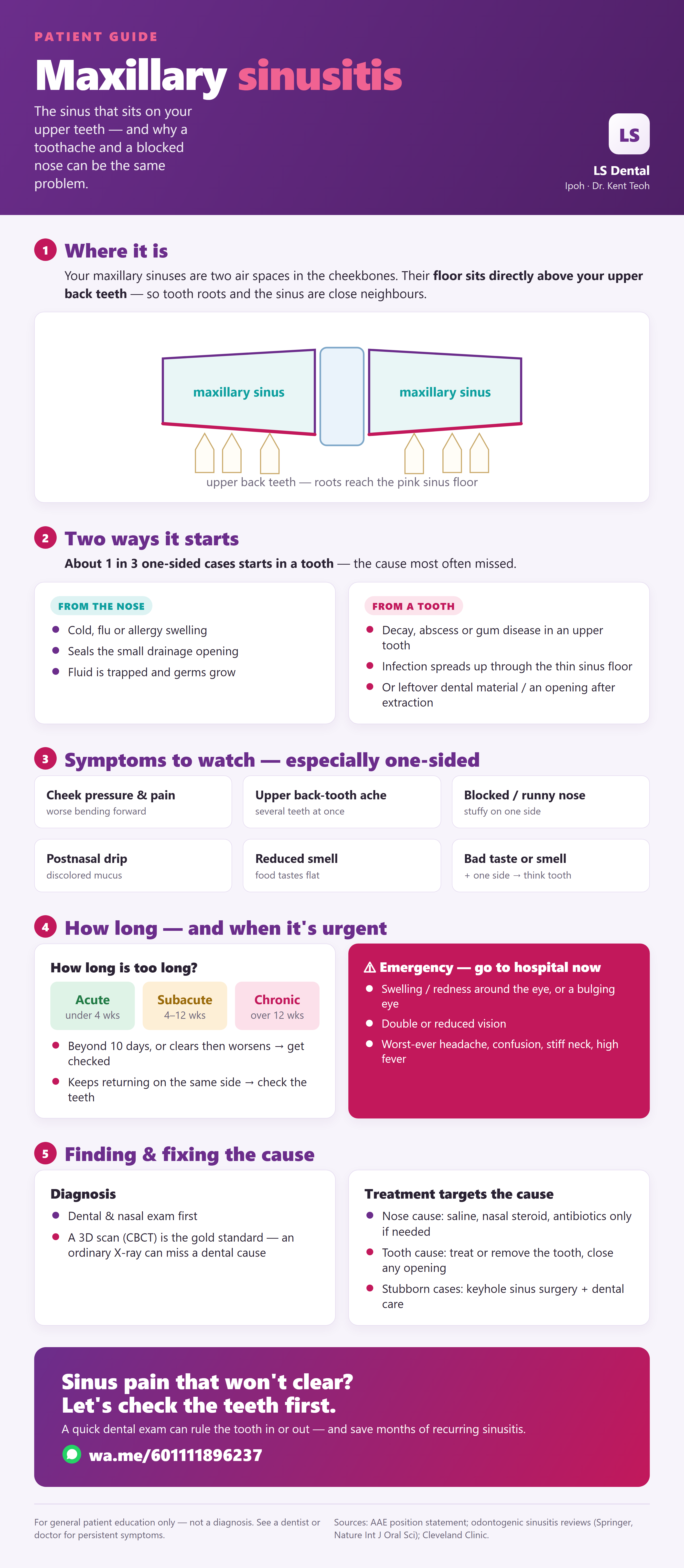 Maxillary sinusitis